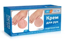До и После крем для рук 100мл для сух огруб кожи
