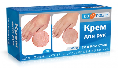 До и После крем для рук 100мл для сух огруб кожи
