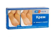До и После крем для ног 50мл п/трещин в ступнях