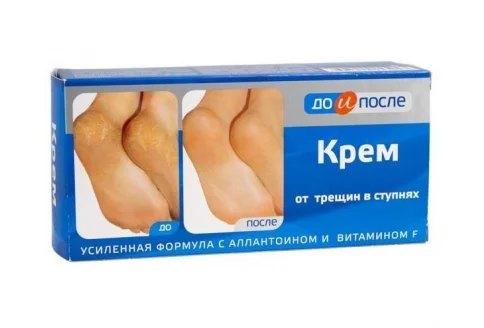 До и После крем для ног 50мл п/трещин в ступнях