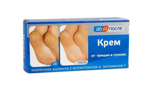 До и После крем для ног 50мл п/трещин в ступнях