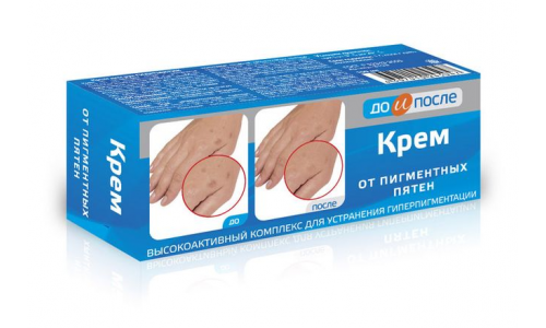 До и После крем от пигм пятен 50мл